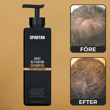 SPARTAN™ - Root Activator Shampoo